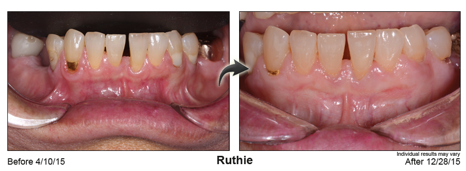 pst dentist Mill Valley California